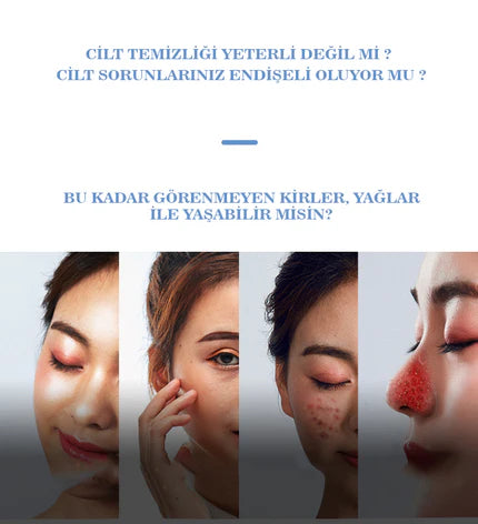 HYDRA Vakum Temizleyici ( 0.8 W Ultra Güçlü Çekim Gücü )