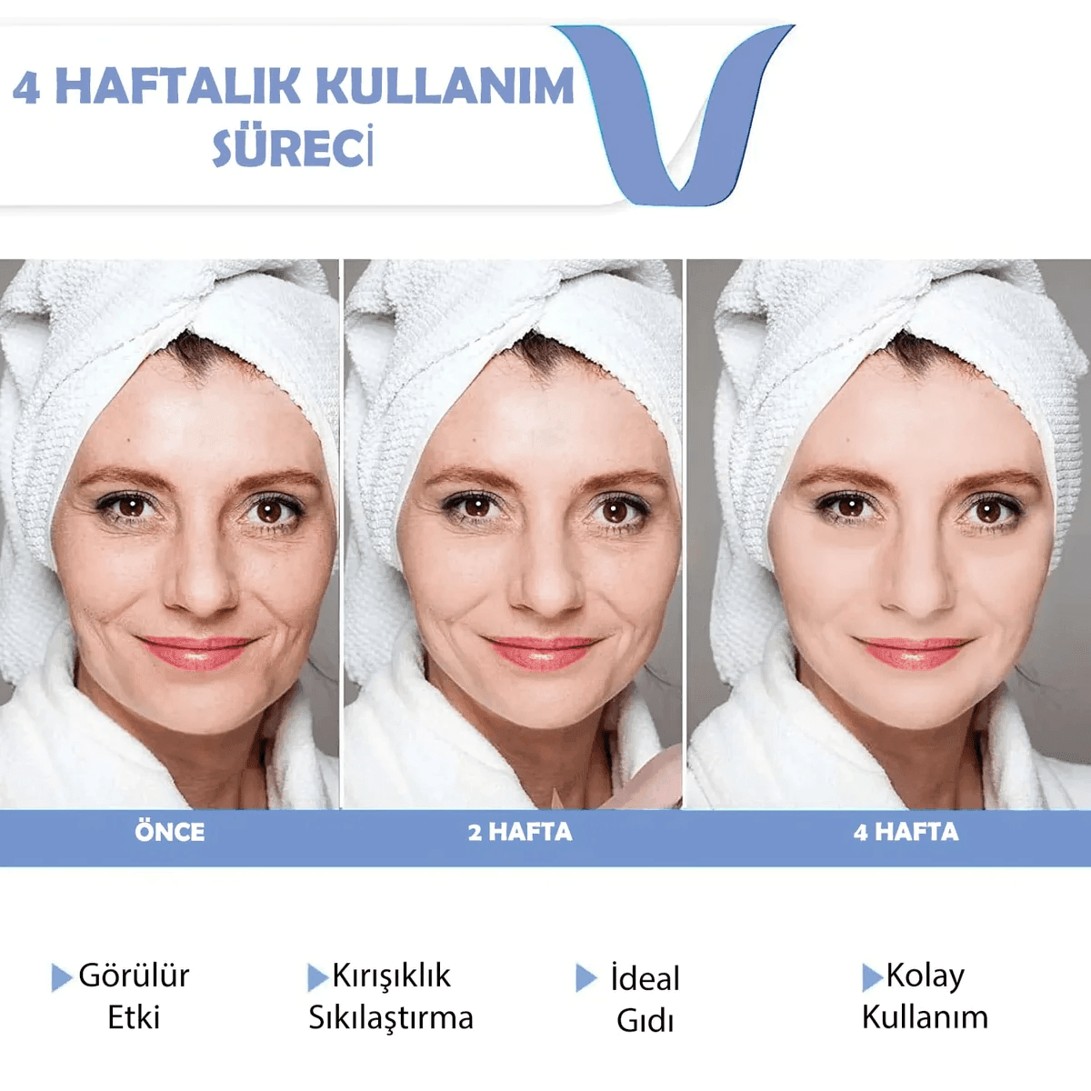 V-Face Gıdı Eritme Kemeri
