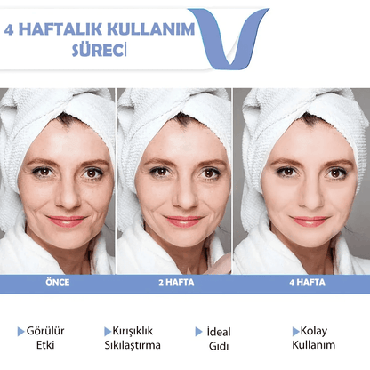V-Face Gıdı Eritme Kemeri