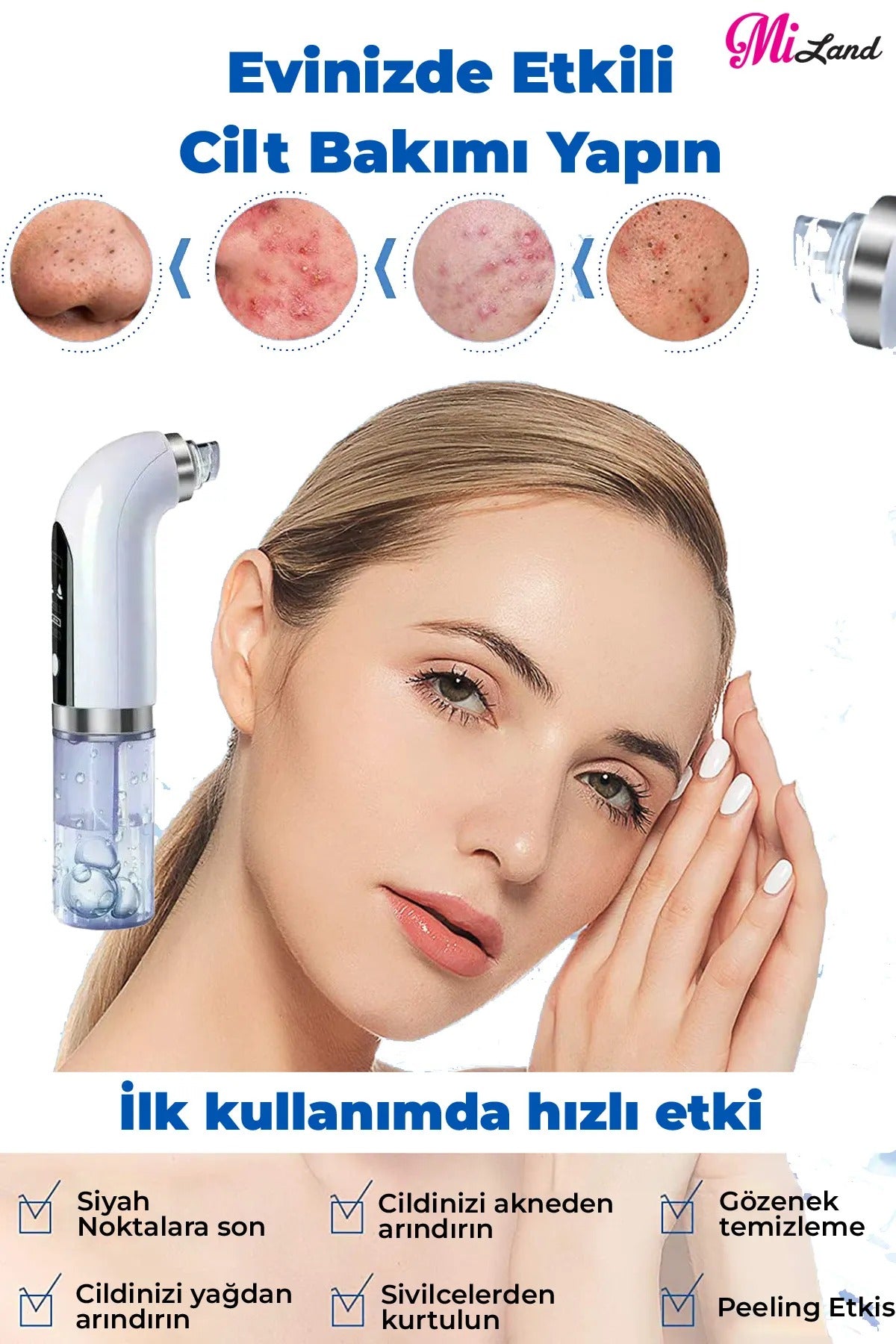 HYDRA Vakum Temizleyici ( 0.8 W Ultra Güçlü Çekim Gücü )